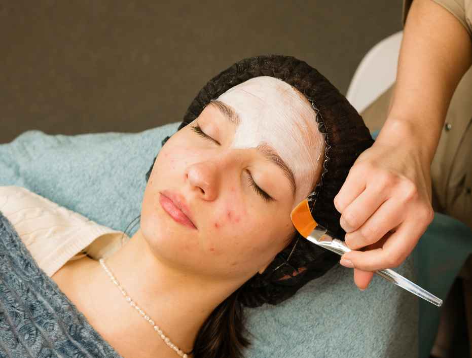 Redukcja trądziku we wrocławskim salonie kosmetycznym.