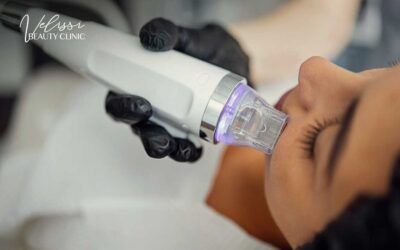 Na czym polega radiofrekwencja mikroigłowa i gdzie wykonać ją we Wrocławiu?