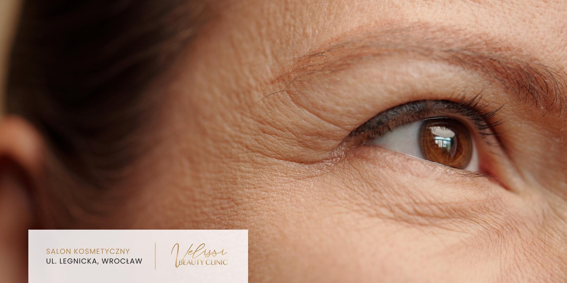 zmarszczki-mimiczne-uśmiech-Velissi